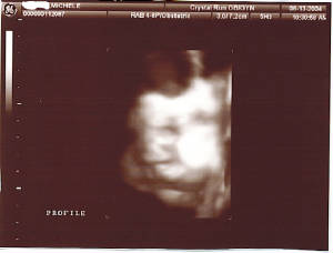 37w5d.jpg